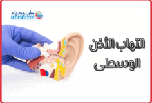 التهاب الأذن الوسطى 001