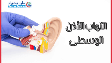 التهاب الأذن الوسطى 001