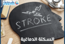 السكتة الدماغية 001