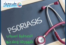 الصدفية 001
