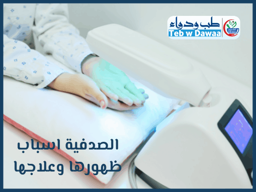 الصدفية 004