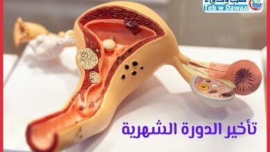 تأخير الدورة الشهرية 001