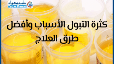 كثرة التبول 001