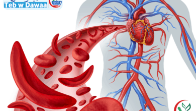 نقص الحديد 001