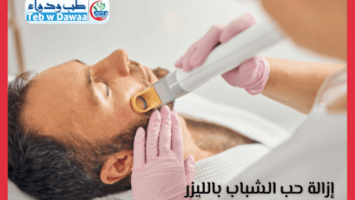 ازالة حب الشباب بالليزر 001