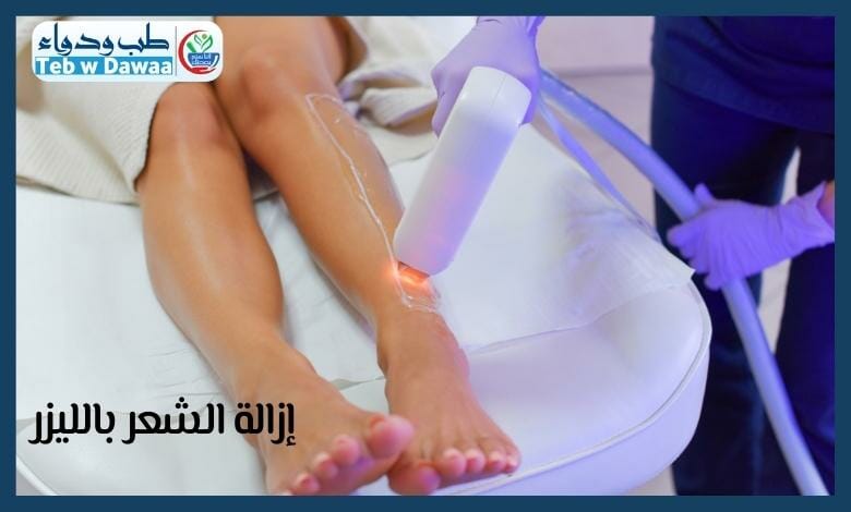 ازالة الشعر بالليزر 001