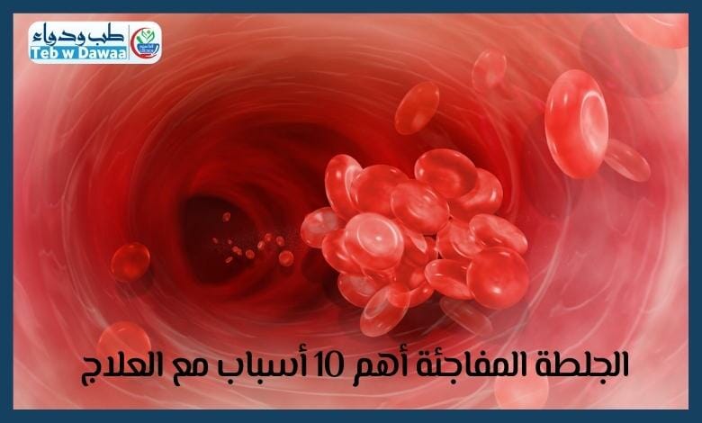 الجلطة المفاجئة 002
