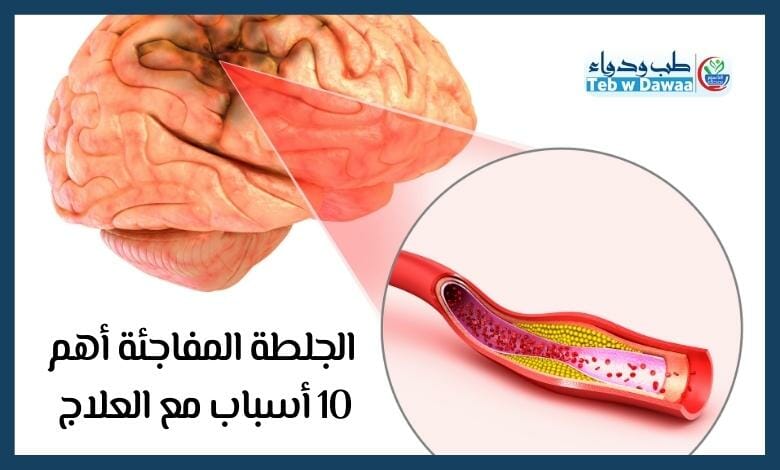 الجلطة المفاجئة 004
