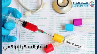 السكر التراكمي 001