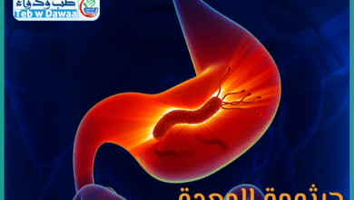 جرثومة المعدة 001