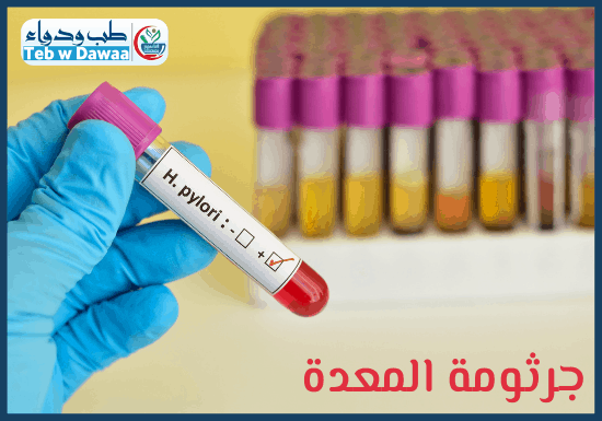 جرثومة المعدة 002