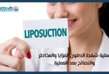 عملية شفط الدهون 001