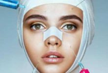 عملية تجميل الأنف