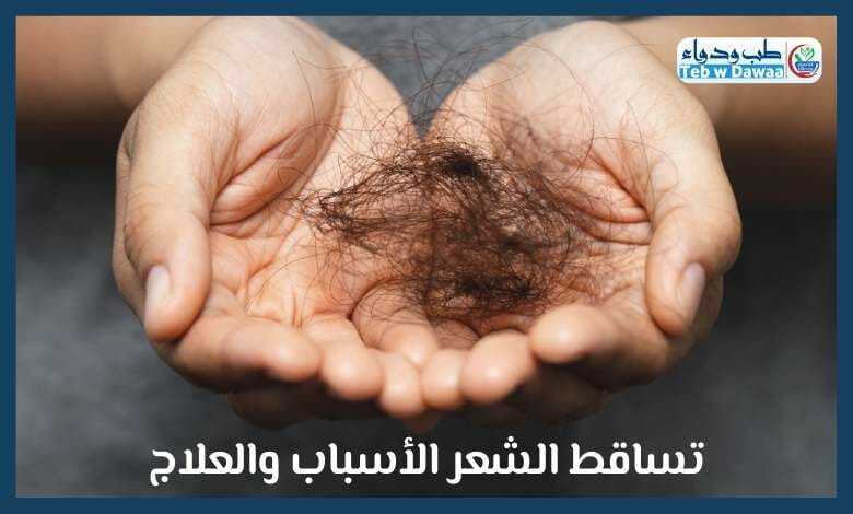 تساقط الشعر 002