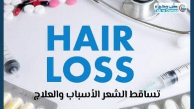 تساقط الشعر 001