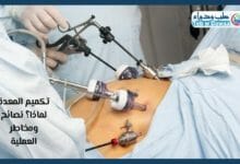 تكميم المعدة 001