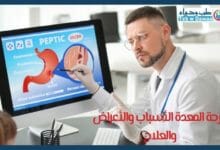 قرحة المعدة 001