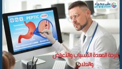 قرحة المعدة 001