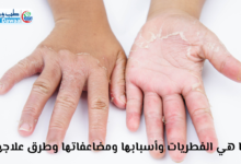 الفطريات الجلدية