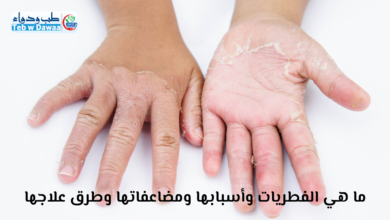 الفطريات الجلدية
